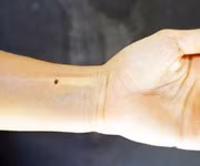 6. Nốt ruồi ở cổ tay. Theo các nhà nghiên cứu, những người có nốt ruồi ở tay là những người có khả năng thiên bẩm, họ khá thông minh và nhanh nhẹn. Họ có khả năng nắm bắt những điều liên quan tới các lĩnh vực chuyên môn khá nhanh nhạy. Con đường sự nghiệp của nhóm người này cũng có xu hướng thẳng tiến đều đều theo thời gian. Đặc biệt, thời điểm rực rỡ nhất của họ được xác định là khi họ bước qua tuổi 35.