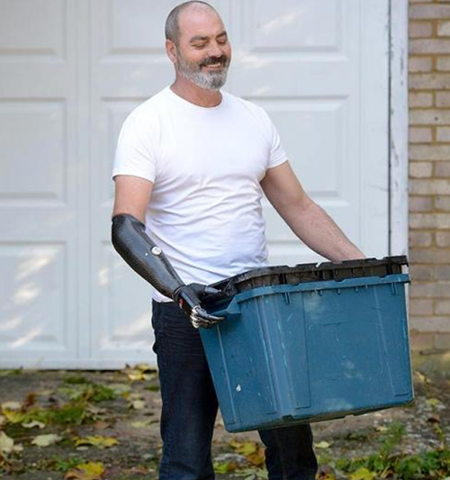 Nigel Ackland có thể điều khiển cánh tay giả bằng chuyển động cơ ở phần cẳng tay còn lại với phạm vi chuyển động đáng kinh ngạc.