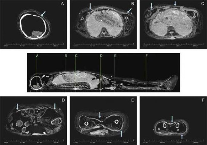 Cô gái 3.200 tuổi được ướp xác 2 lần theo cách lạ lùng nhất thế giới - Ảnh 3.