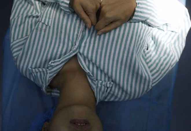 Ngày 11/11 vừa qua (ngày độc thân tại Trung Quốc), cô gái độc thân đã quyết định đến Thượng Hải du lịch và dao kéo tại đây. Cô đã trao đổi rất nhiều với các bác sĩ và cho phép một nhiếp ảnh gia theo cô chụp lại toàn bộ quá trình phẫu thuật tìm kiếm tình yêu có phần cực đoan của mình. Trong ảnh, cô tỏ ra khá sợ hãi và hồi hộp trước khi vào phòng mổ.