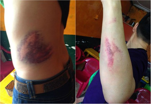 Bức ảnh chụp các vết thương trên người Long Ka và hình ảnh chú chó đáng thương bị đánh chết khiến cư dân mạng phẫn nộ. Rất nhiều người đã chia sẻ những bức ảnh này và cùng hỗ trợ tìm ra những kẻ gây chuyện.