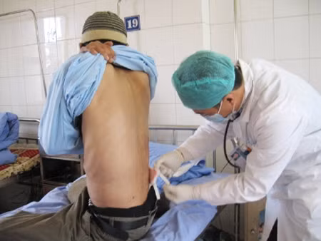 Bác sĩ đang điều trị cho một bệnh nhân bị bệnh lao. Ảnh: Thái Hà/TPO