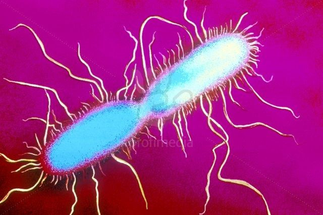Dù vậy, các triệu chứng của bệnh Cocoliztli không giống với triệu chứng bệnh do vi khuẩn salmonella gây ra, nên quan điểm nên trên vẫn chưa được xác nhận, và "thủ phạm" thực vẫn chưa được đưa ra ánh sáng.