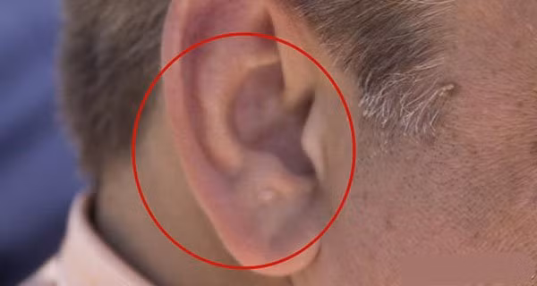 Dan ong suc khoe tot co 4 bo phan to hon nguoi