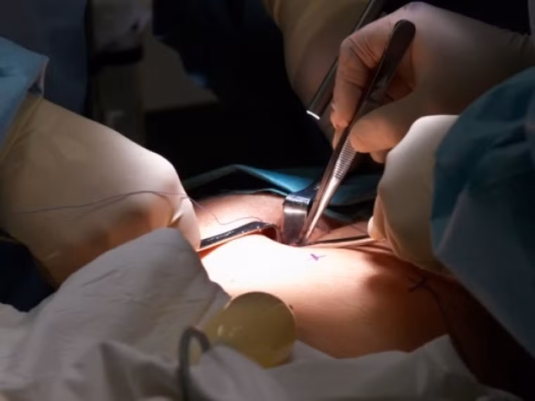 Do ung thư tụy có độ ác tính cao, tỉ lệ phẫu thuật cắt bỏ thấp, tiên lượng không tốt. Mặc dù phẫu thuật là phương pháp điều trị được ưu tiên hàng đầu, nhưng ung thư tụy khi phát hiện thường đã ở giai đoạn cuối nên mất đi cơ hội điều trị tận gốc. Do đó cần áp dụng điều trị tổng hợp cho bệnh nhân ung thư tụy mới mong có kết quả.