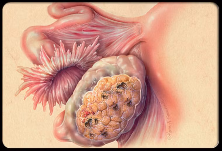 Và kích thước vòng bụng ngày càng gia tăng.