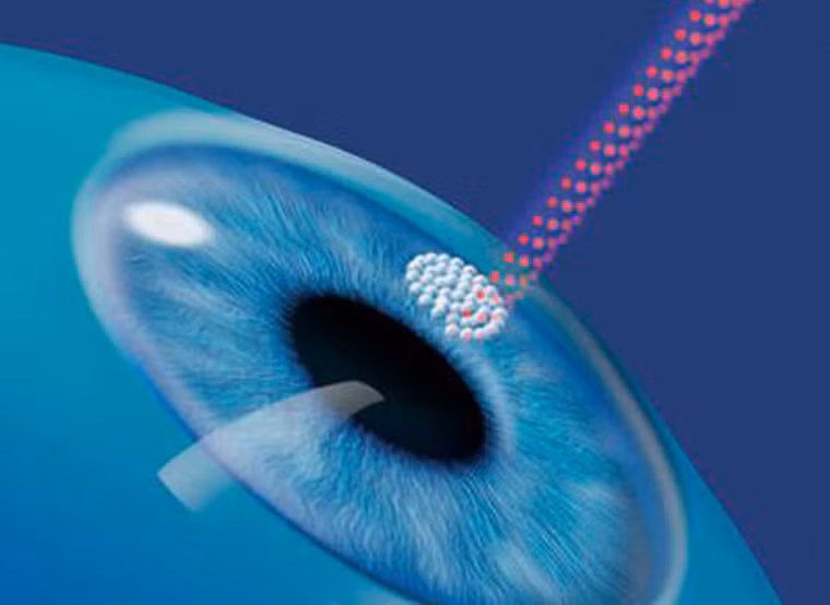 Lựa chọn phẫu thuật. Nếu mắt gặp trục trặc, bạn có thể cân nhắc phương pháp phẫu thuật laser. Phương pháp này có khả năng cải thiện tầm nhìn đáng kể. Trước khi quyết định, bạn nên tham khảo ý kiến bác sĩ nhãn khoa. Họ sẽ giúp bạn kiểm tra hiện trạng đôi mắt và đưa ra lời khuyên phù hợp.