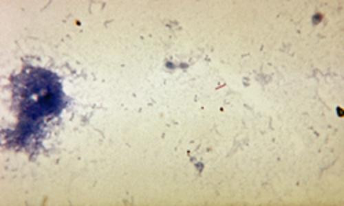 Trong một cuộc khai quật, người ta đã tìm thấy những tổn thương đặc trưng đã được do bệnh lao trên bộ xương khai quật được ở Thổ Nhĩ Kỳ có niên đại khoảng 500.000 năm trước đây.