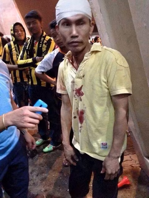 Một fan Malaysia đăng tải tấm ảnh CĐV Việt Nam bê bết máu cùng dòng nhắn: "Xin lỗi bạn. Hãy tha thứ cho chúng tôi".