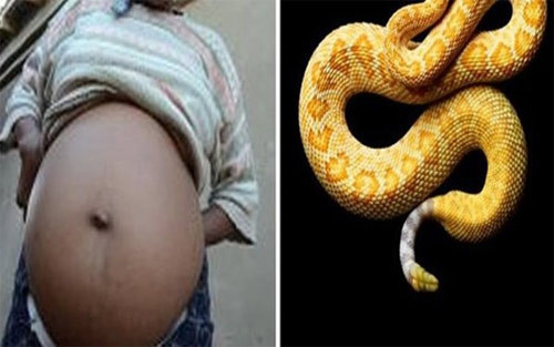 Nhiều người tin rằng mình bị rắn chui vào dạ dày sinh sống khiến bụng to lên. Ảnh minh họa.