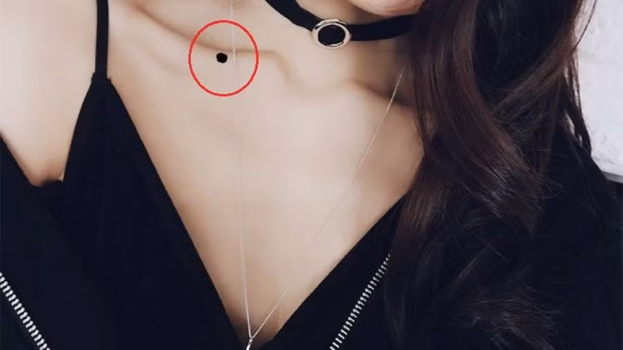 4 nốt ruồi thiên kim, phụ nữ chỉ cần 1 là mang mệnh phượng hoàng - Hình 2 4 not ruoi thien kim, phu nu chi can 1 la mang menh phuong hoang-Hinh-2