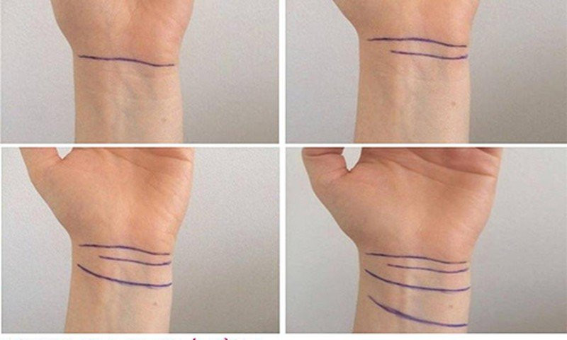 Nhìn ngấn cổ tay 5 giây biết vận mệnh sang hèn hay sướng khổ Nhin ngan co tay 5 giay biet van menh sang hen hay suong kho