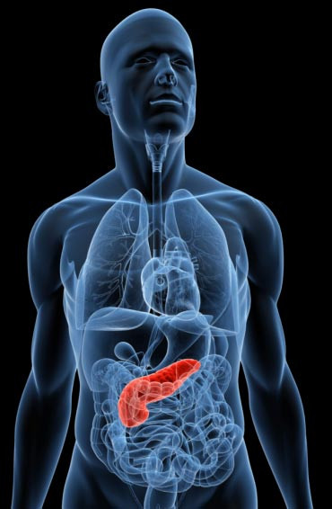 Tỷ lệ sống của các ca mắc ung thư tuyến tụy gần như là thấp nhất trong tất cả các loại bệnh do rất khó phát hiện và xu hướng phát triển ác tính rất cao.