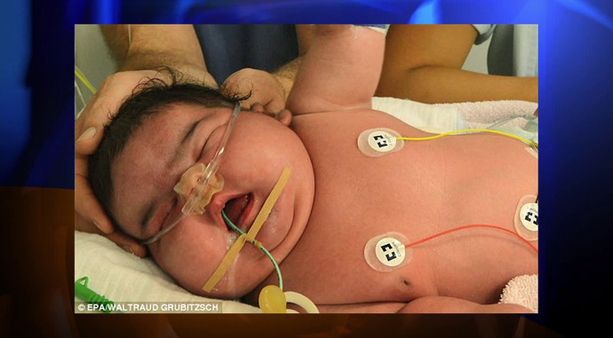 Em bé sinh ra nặng hơn 6k, được sinh thường.