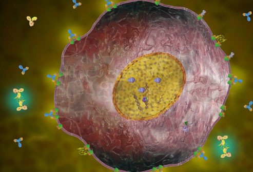 Ung thư vú HER2 dương tính: Ở khoảng 20% bệnh nhân, các tế bào ung thư có quá nhiều thụ thể đối với một loại protein được gọi là HER2. Đây là loại ung thư được gọi là HER2 dương tính, và nó có xu hướng lây lan nhanh hơn so với các dạng ung thư vú khác. Trong ảnh: Một tế bào ung thư vú HER2 dương tính với tín hiệu phát triển bất thường thể hiện ở màu xanh lá cây.