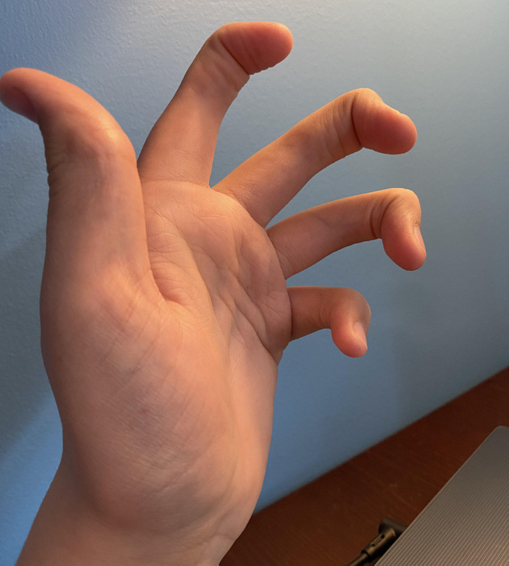 "Không ngón tay nào của tôi có khớp giữa".