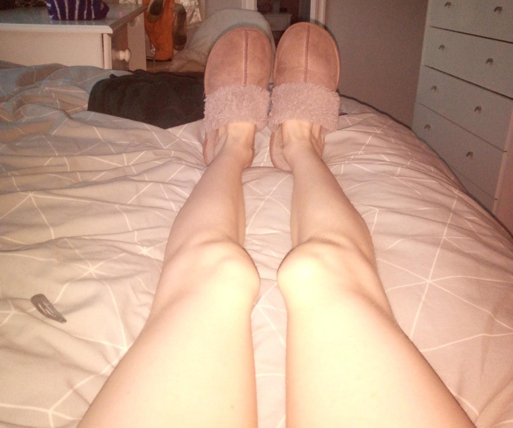 “Tôi sinh ra đã bị khuyết tật ở chân nên đầu gối của tôi hướng vào trong ở hai bên chân".