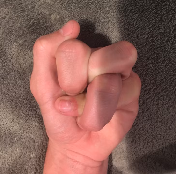 Cơ thể của mỗi chúng ta có thể chứa một thứ gì đó khác lạ mà chúng ta chưa khám phá ra vì đó là những điểm nhỏ, không gây ấn tượng mạnh, rõ nét, dễ nhận biết như những ví dụ dưới đây. Những bức ảnh chứng minh cơ thể con người thực sự là một 'thế giới thần tiên': “Tôi có thể tạo một 'hình vuông' bằng các ngón tay của mình".