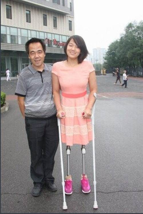 Quin Hongyan giờ đã lớn, xinh đẹp và không còn phải dùng nửa quả bóng rổ để di chuyển nữa nhưng biệt danh "cô bé bóng rổ" vẫn được nhiều người nhắc đến khi nói về cô.