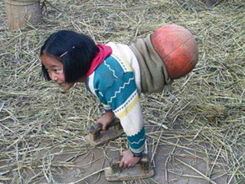 Để tránh cho tay của cô bé khỏi trầy xước khi di chuyển, ông nội của cô đã cho cô bé dùng 2 chiếc bàn xoa (dùng trong xây dựng) để di chuyển dễ dàng và hạn chế thương tổn cho đôi tay hơn.