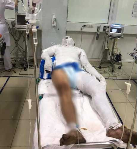 Vụ thiêu sống nam công nhân ở Nghệ An: Tạm giữ 1 nghi can Vu thieu song nam cong nhan o Nghe An: Tam giu 1 nghi can