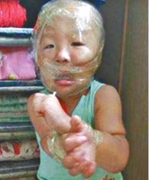 Hình ảnh học sinh bị cô giáo mầm non trừng phạt và đăng tải lên WeChat.