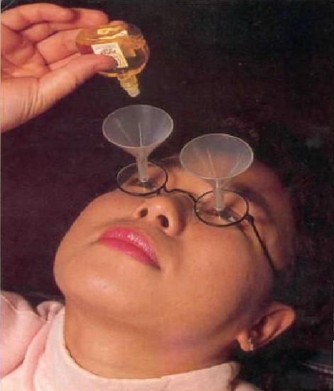 Nhỏ mắt thế này cho không bị ra rơi ra ngoài.