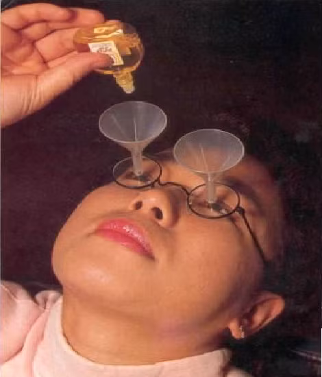 Nhỏ mắt thế này cho không bị ra rơi ra ngoài.