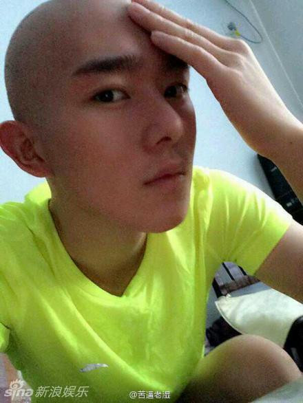 Cho đến khi đầu chàng trai trút sạch những sợi tóc cuối cùng.