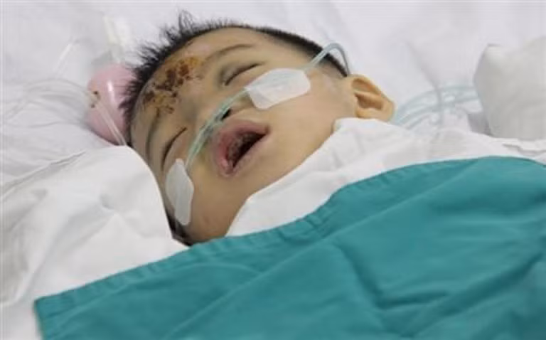 Cháu Thiên Bảo ngày được đưa từ Bình Thuận về cấp cứu ở BV Nhi Đồng 2, TP HCM sau vụ TNGT.