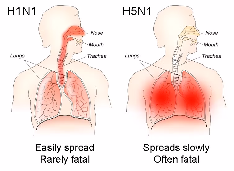 Tác hại của H1N1 và H5N1 trên cơ thể con người. Ảnh: Wikipedia.