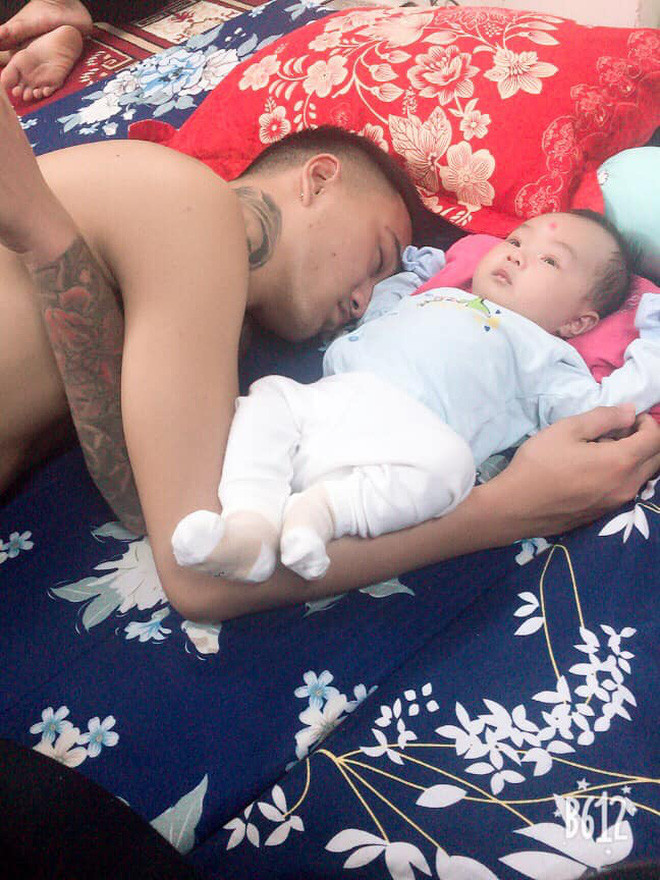 Cuoi vo bung khoanh khac cac bo trong con-Hinh-2