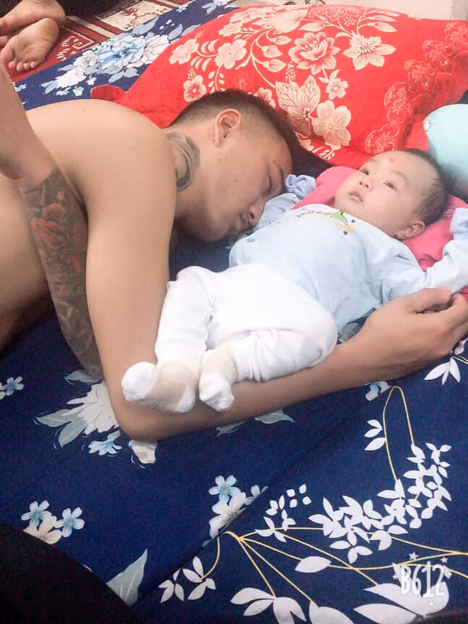 Cuoi vo bung khoanh khac cac bo trong con-Hinh-2