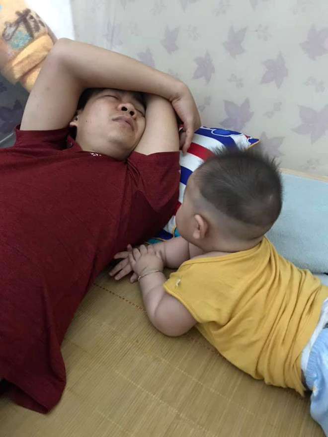 Cuoi vo bung khoanh khac cac bo trong con-Hinh-4