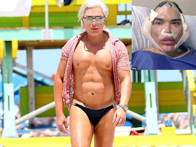 Búp bê Ken đã phẫu thuật chuyển giới thành nữ - Hình 7 Bup be Ken da phau thuat chuyen gioi thanh nu-Hinh-7