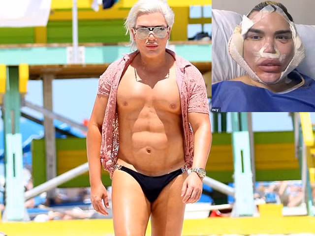 Bup be Ken da phau thuat chuyen gioi thanh nu-Hinh-7