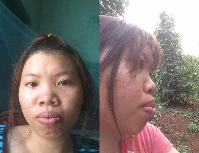 Co gai tung bi chong bo vi xau nhu Thi No