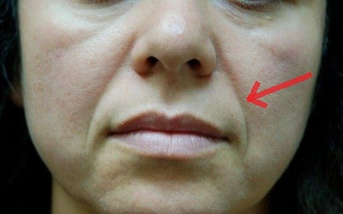 Những nét tướng phụ nữ kém may mắn trong hôn nhân - Hình 2 Nhung net tuong phu nu kem may man trong hon nhan-Hinh-2