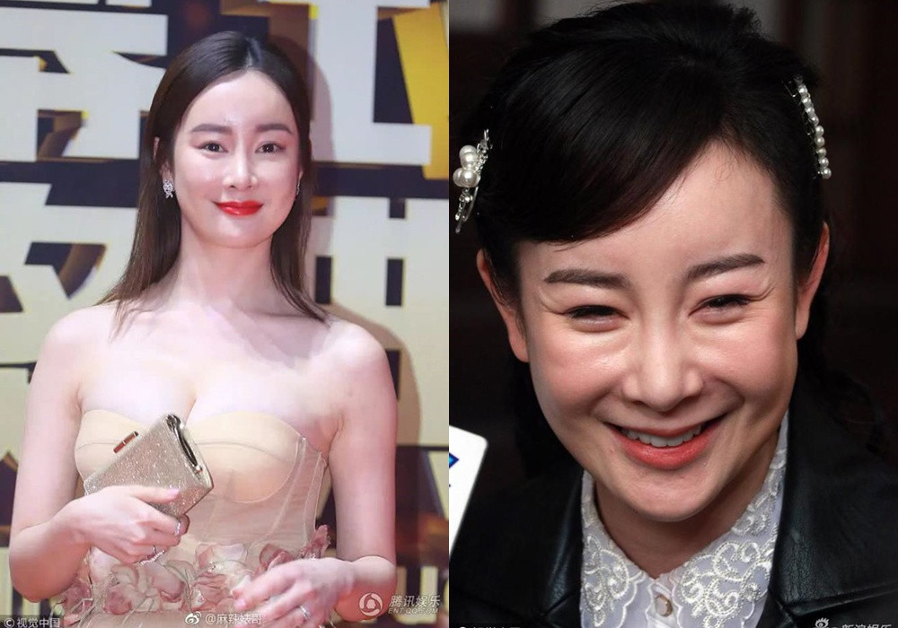 Bi kich nhung nguoi dep noi tieng phau thuat tham my hong-Hinh-2