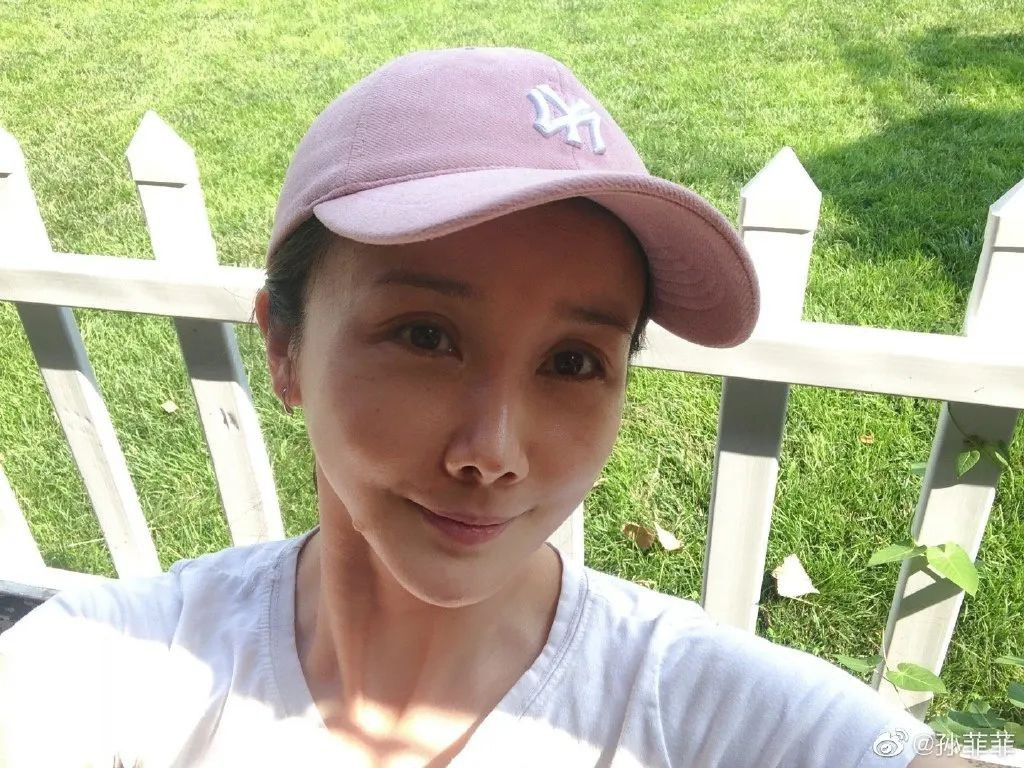 Bi kich nhung nguoi dep noi tieng phau thuat tham my hong-Hinh-9