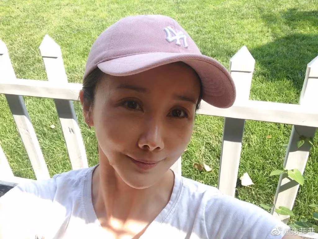 Bi kich nhung nguoi dep noi tieng phau thuat tham my hong-Hinh-9