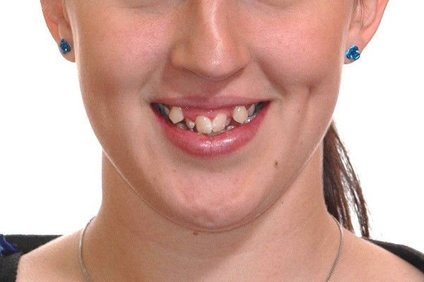 Tuong mat phu nu long da tham sau, khong nen dong vao-Hinh-2