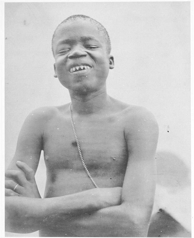 Thảm kịch bí ẩn của người lùn bị nhốt trong sở thú ảnh 2