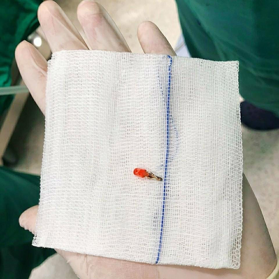 Cảnh giác với những món đồ chơi gây nguy hiểm tính mạng trẻ - Hình 2 Canh giac voi nhung mon do choi gay nguy hiem tinh mang tre-Hinh-2