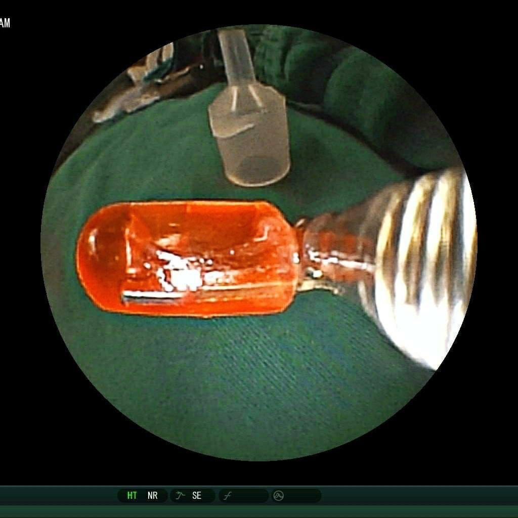 Cảnh giác với những món đồ chơi gây nguy hiểm tính mạng trẻ Canh giac voi nhung mon do choi gay nguy hiem tinh mang tre