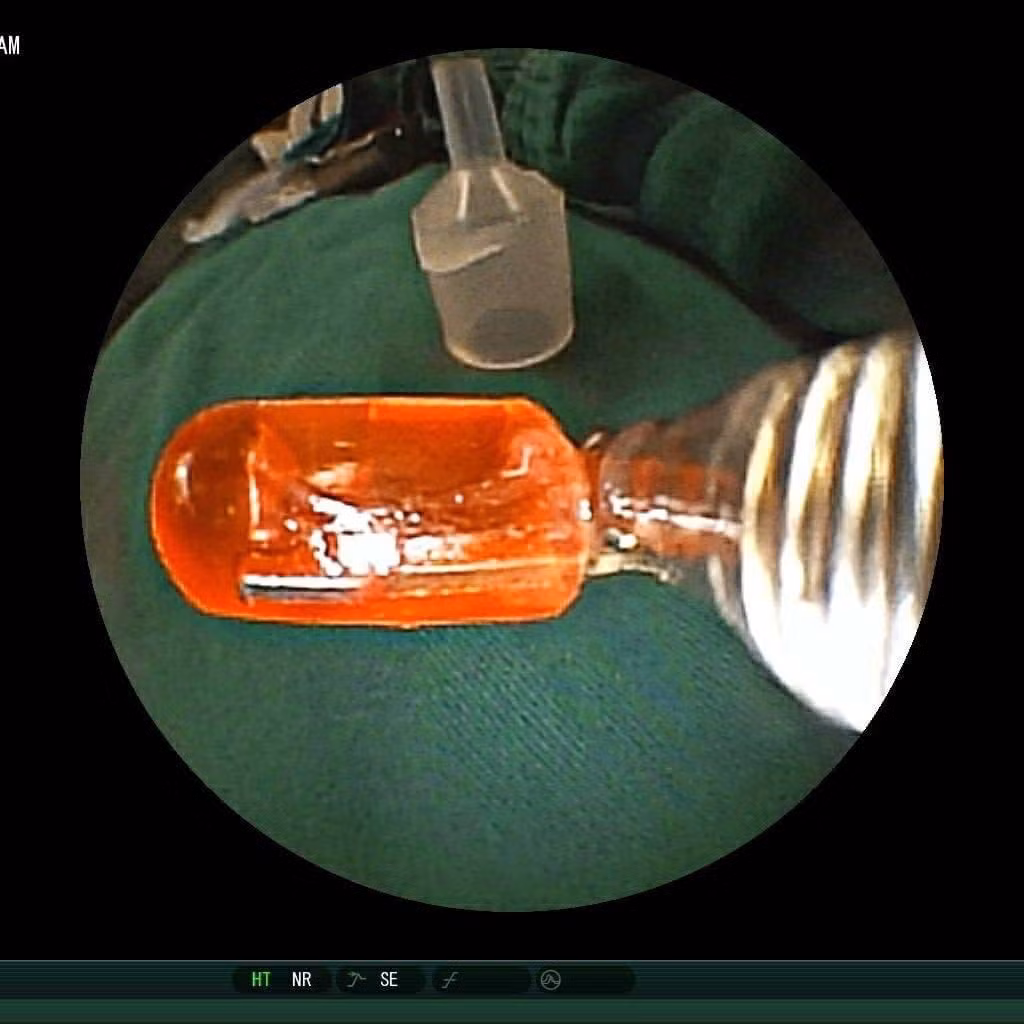 Canh giac voi nhung mon do choi gay nguy hiem tinh mang tre