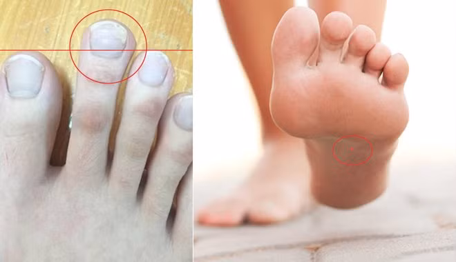 Đàn ông sở hữu 3 tướng chân giàu có, chắc chắn làm quan to Dan ong so huu 3 tuong chan giau co, chac chan lam quan to