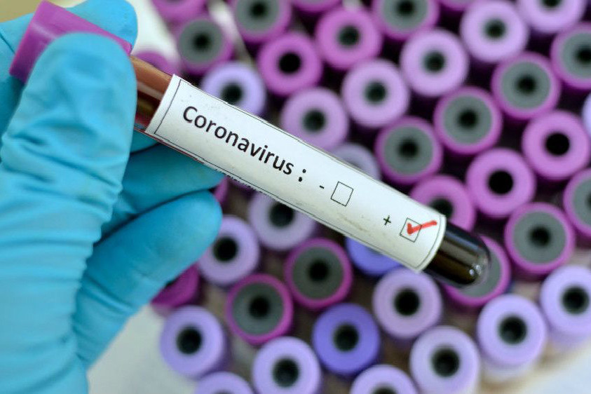 Canon phat trien KIT test nhanh COVID-19 trong 40 phut