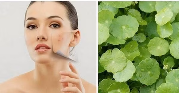 Rau ma: Cuc tot va cuc doc, biet ma tranh khi an keo mang hoa vao than-Hinh-2