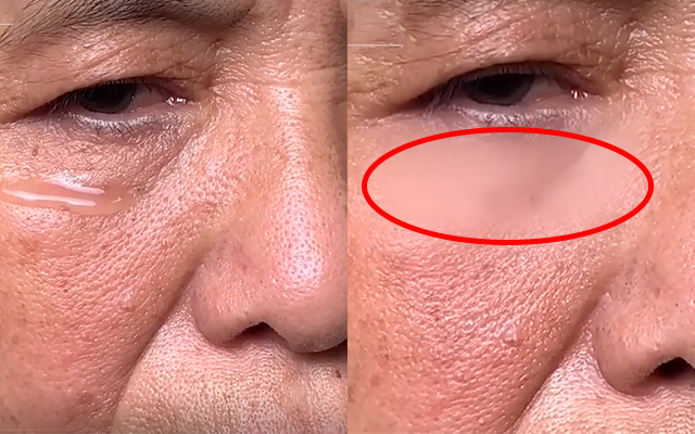 ông dụng quá thần kỳ khiến lọ serum này được gọi là "thuốc tiên", "thần dược".